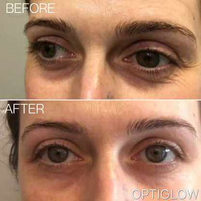 Optiglow Peptide Collagen Hydrogel Eye Patch