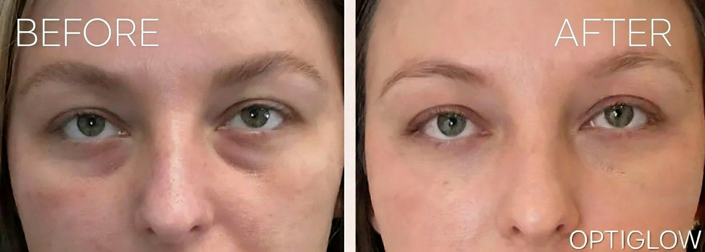 Optiglow Peptide Collagen Hydrogel Eye Patch