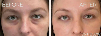 Optiglow Peptide Collagen Hydrogel Eye Patch